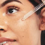 Hyperpigmentation