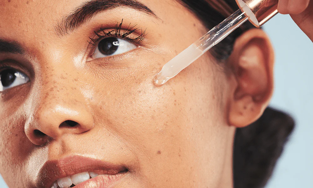 Hyperpigmentation